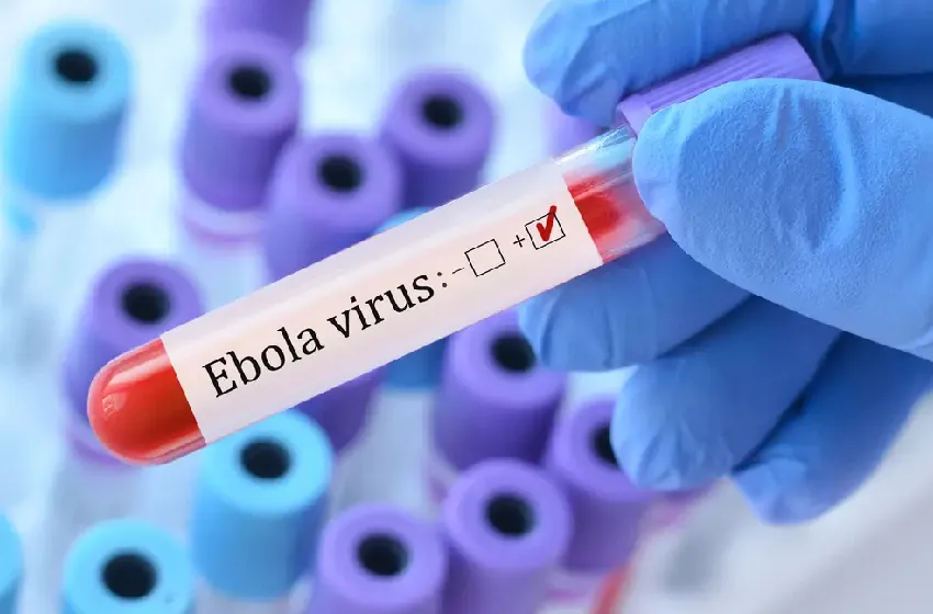 الولايات المتحدة.. توجيه الرحلات الجوية القادمة من المناطق المتضررة من "إيبولا" نحو مطار في فيرجينيا