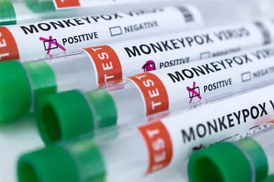 الأردن تسجل حالة إصابة بجدري القرود