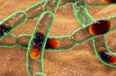 جنوب إفريقيا .. تأكيد حالات إصابة بالجمرة الخبيثة لدى حيوانات بمنتزه كروغر