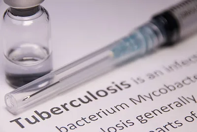 اليوم العالمي لمحاربة داء السل.. محطة سنوية لإبراز جهود المغرب في مكافحة هذا المرض