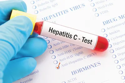 وزارة الصحة تطلق حملة وطنية للكشف عن التهاب الكبد الفيروسي