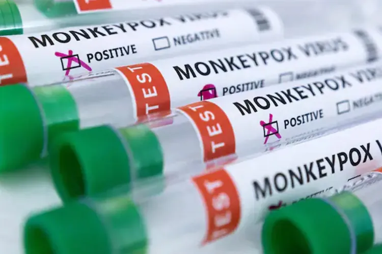 الأردن تسجل حالة إصابة بجدري القرود