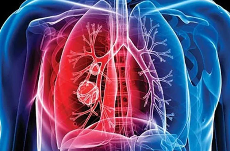 اليوم العالمي لمحاربة داء السل .. التزام متجدد للقضاء على الداء (وزارة)