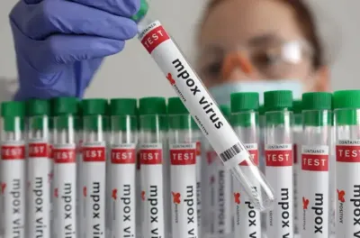 Mpox: l'OMS annonce l'arrivée prochaine des premiers vaccins en RDC